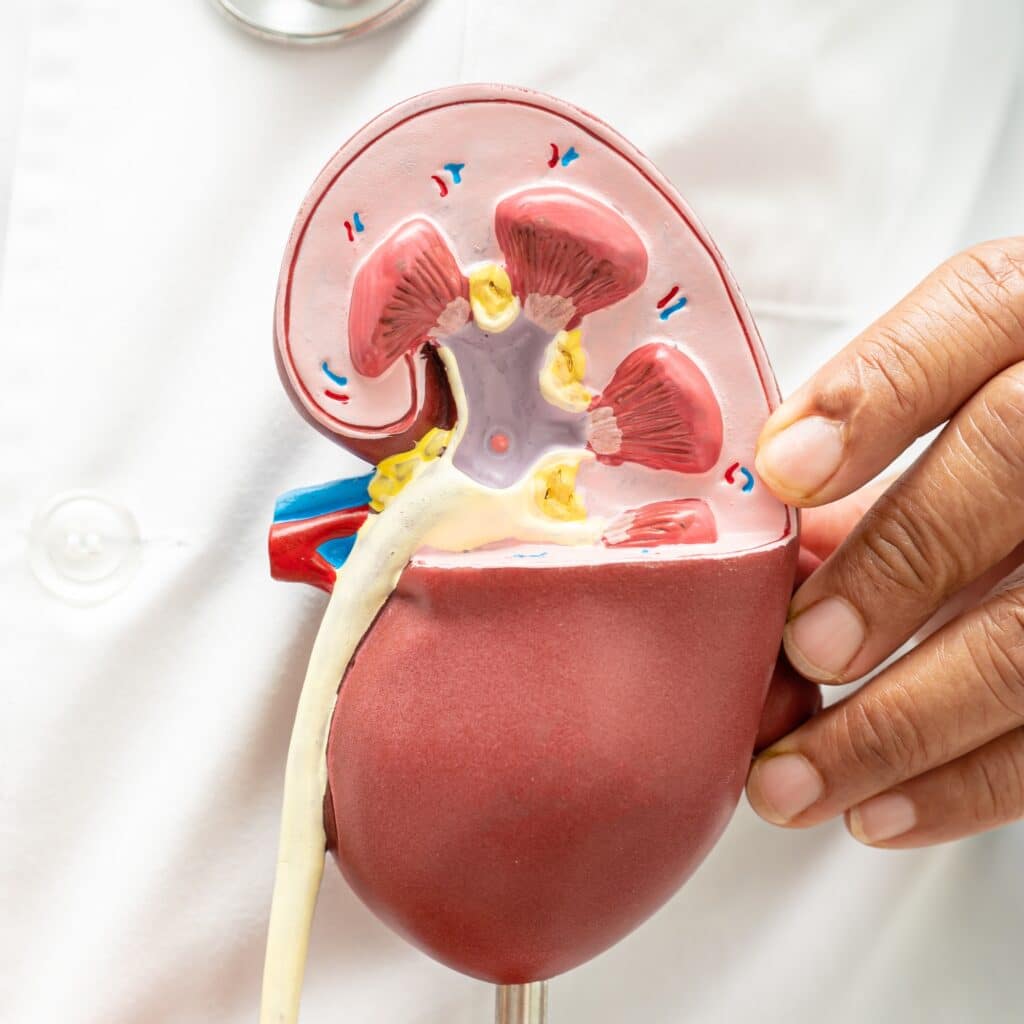 What Is Chronic Kidney Disease - Renal Diet HQ